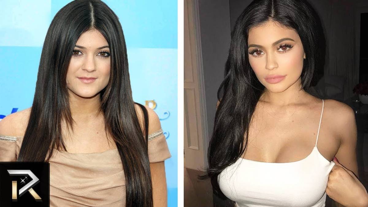 Hollywood’s Most Shocking Celebrity Transformations